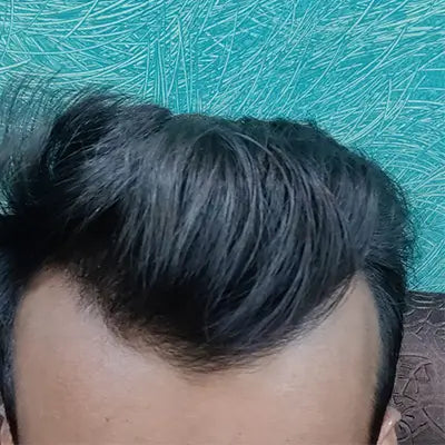 After - Amit Chauhan