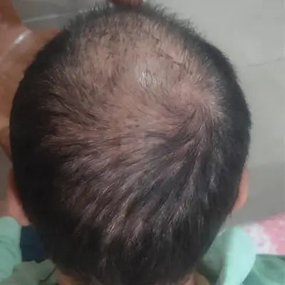 Before - Laxman