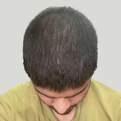 After - Mohit