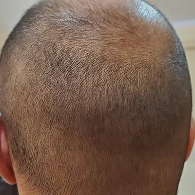 Before - Mohit