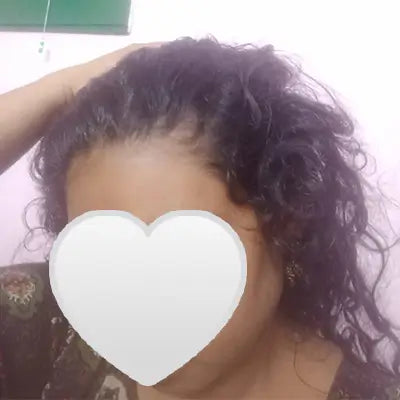 Before - Rupali Das
