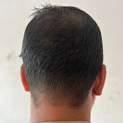 After - Vikram
